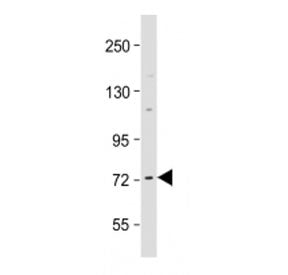 Western blot testing of Raf1 antibody at 1:2000 + human MCF7 cell lysate. Predicted molecular weight