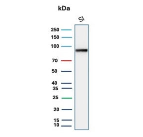 Western blot testing of human small intestine tissue lysate with Cadherin 17 antibody (clone CDH17/2
