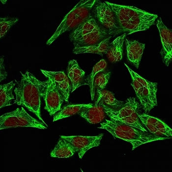 KRT7 Antibody / Cytokeratin 7