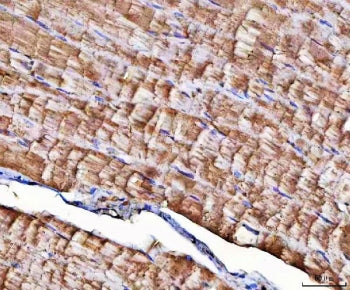 IHC staining of FFPE human skeletal muscle tissue with NT5C1A antibody. HIER: boil tissue sections i