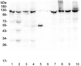 Western blot testing of 1) rat liver, 2) rat lung, 3) mouse liver, 4) mouse lung, 5) rabbit IgG, 6) 