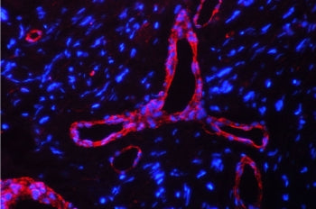 Caveolin-1 Antibody