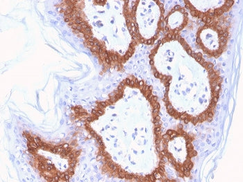 IHC staining of FFPE human skin with Cytokeratin 14 antibody (clone LL002). HIER: boil tissue sectio