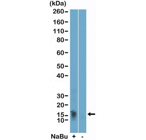 Western blot testing of acid extracts of HeLa cells, treated (+) or untreated (-) with sodium butyra