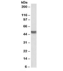 Western blot testing of human colon lysate with Cytokeratin 20 antibody at 0.03ug/ml. Predicted mole