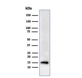 Western blot testing of human HeLa cell lysate using recombinant FABP5 antibody (clone rFABP5/6354). Predicted molecular weight ~15 kDa.