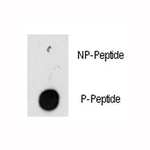 Dot blot analysis of phospho-ILK antibody. 50ng of phos-peptide or nonphos-peptide per dot were spot