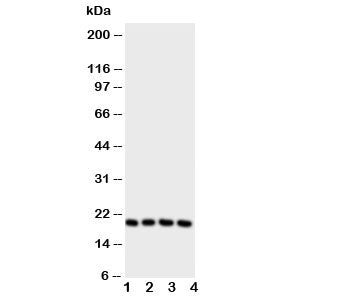 Western blot testing of LCN1 antibody and Lane 1: Jurkat; 2: COLO320; 3: SCG; 4: HeLa cell lysate