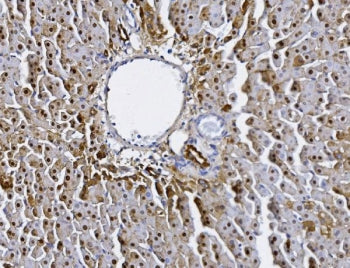 IHC staining of FFPE rat liver tissue with Alanine aminotransferase 1 antibody. HIER: boil tissue se
