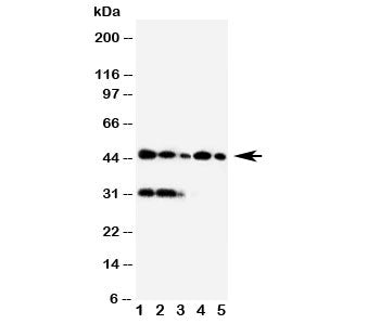 Western blot testing of Haptoglobin antibody and Lane 1: Raji; 2: HL-60; 3: HUT102; 4: Jurkat; 5: CE