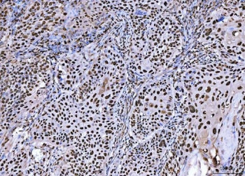 BRCA1 Antibody
