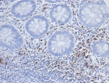 IHC staining of FFPE human colon tissue with S100A4 antibody (clone S100A4/6803). HIER: boil tissue 