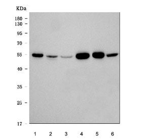 Western blot testing of 1) human SH-SY5Y, 2) human Jurkat, 3) human A549, 4) rat brain, 5) mouse bra