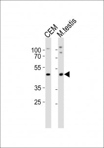 Lhx1 Antibody