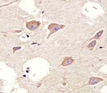 IHC testing of FFPE human brain tissue with CHRM2 antibody. HIER: steam section in pH6 citrate buffe