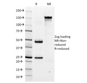 Helicobacter pylori Antibody