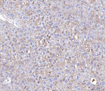 Poliovirus Receptor Antibody / PVR