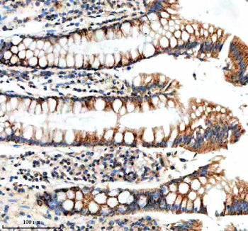 Immunohistochemical staining of NUDT8 using anti-NUDT8 antibody. NUDT8 was detected in a paraffin-em