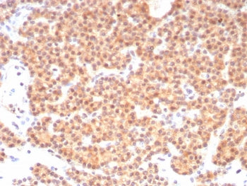c-RET Antibody