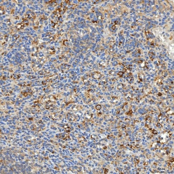 Syntaphilin Antibody / SNPH