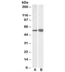 Western blot testing of human [A] and mouse [B] brain lysate with GDH antibody at 0.03ug/ml. Predict