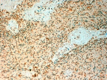 IHC testing of FFPE human spleen with TET2 antibody at 4ug/ml. HIER: steamed with pH6 citrate buffer