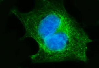 Immunofluorescent staining of FFPE human Caco-2 cells with Fibroblast Growth Factor Receptor 3 antib