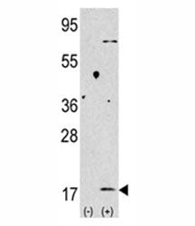 Western blot analysis of LC3B antibody and 293 lysate transiently transfected with the MAP1LC3B gene