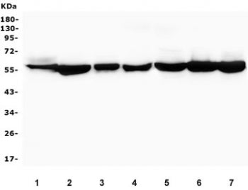 Western blot testing of human 1) placenta, 2) K562, 3) A431, 4) A549, 5) Caco-2, 6) HEK293 and 7) U-