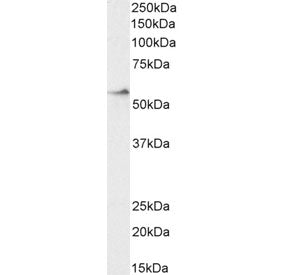 Western blot testing of human duodenum lysate with CRF1 antibody at 2ug/ml. Predicted molecular weig
