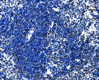 Dectin 1 Antibody / Clec7a