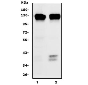 Western blot testing of human 1) Caco-2 and 2) SW620 lysate with PROM1 antibody. Expected molecular 