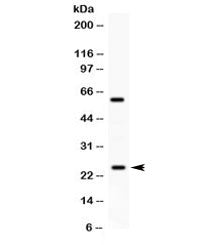 RAB11A Antibody