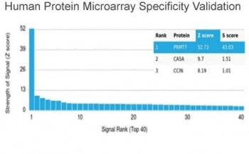 Analysis of HuProt(TM) microarray containing more than 19,000 full-length human proteins using PRMT7