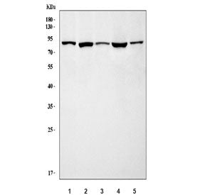 GRK3 Antibody / ADRBK2