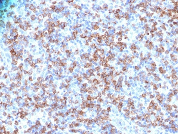 IHC analysis of FFPE human lymphoma with CD8a antibody . Staining of formalin-fixed tissues requires