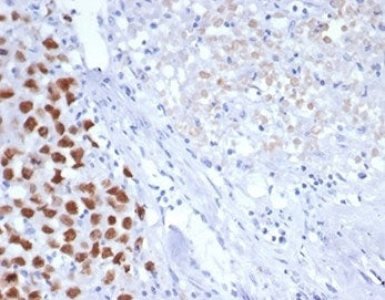 IHC staining of FFPE human pancreas tissue with SALL4 antibody (clone SALL4/7301). HIER: boil tissue