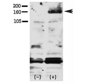Western blot testing of phospho-HER4 antibody and FG pancreatic carcinoma cells treated with or with