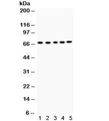 Acetylcholinesterase Antibody / ACHE