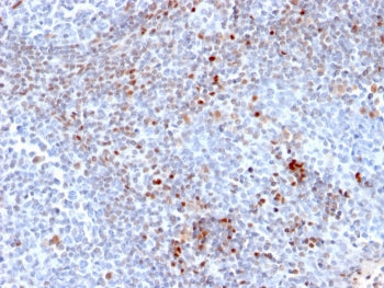 IHC staining of FFPE human tonsil tissue with SATB1 antibody (clone SATB1/2661). HIER: boil tissue s