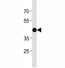 Zebrafish Atf4 Antibody