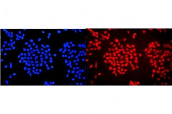 Immunofluorescent staining of FFPE human A431 cells with WAC antibody (red) and DAPI nuclear stain (