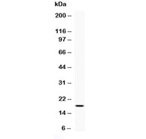 Western blot testing of 0.5ng/lane of human IFNg recombinant protein with human Interferon gamma ant