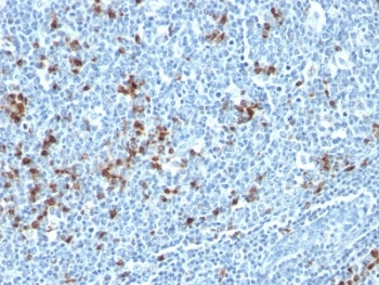 IHC: Formalin-fixed, paraffin-embedded human tonsil stained with Kappa Light Chain antibody (HP6053 