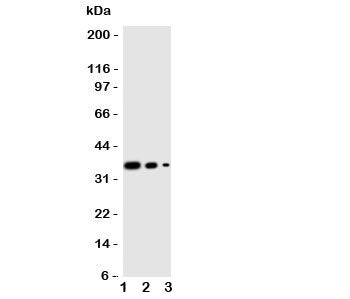 Western blot testing of WNT2B antibody and human recombinant protein, 36KD with tag; Lane 1: 10ng; 2