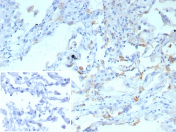 Surfactant protein D Antibody / SFTPD