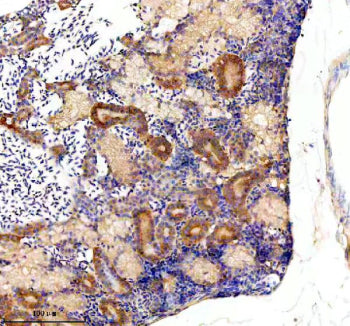 Immunohistochemical analysis of Glula/b protein using Zebrafish Glutamine synthetase antibody and pa