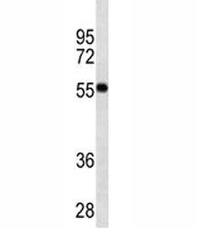 VDR antibody western blot analysis in MDA-MB453 lysate. Predicted molecular weight 48/54 kDa (isofor