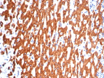 IHC staining of FFPE human liver tissue with IL-18 antibody (clone IL18/4622) at 2ug/ml. HIER: boil 