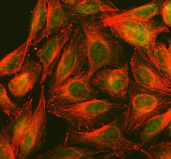 Immunofluorescent staining of FFPE human U-2 OS cells with PPP2R5D antibody (green) and Alpha Tubuli